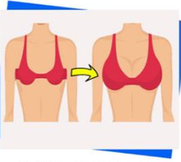 Home breast increase treatment